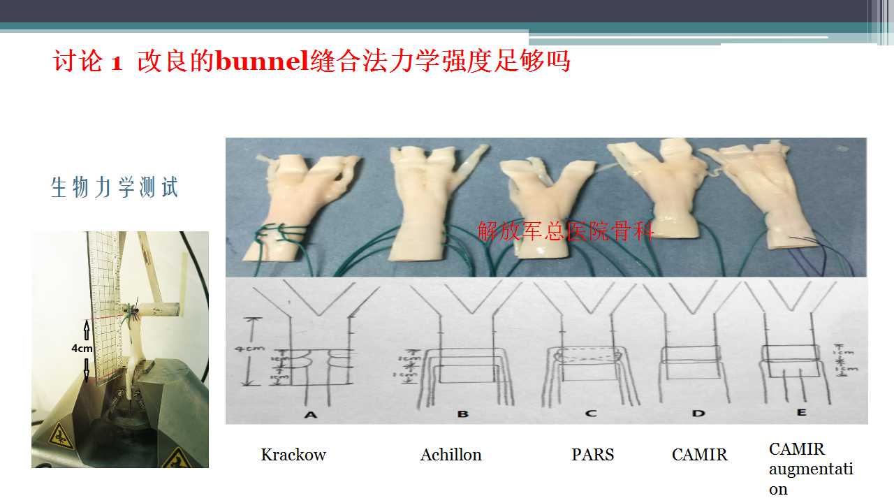 跟腱断裂治疗存在的问题及解决策略