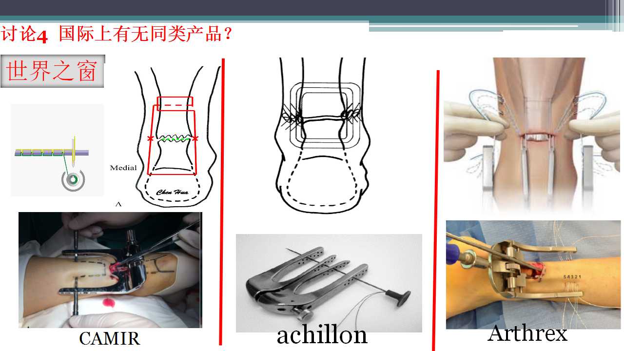 跟腱断裂治疗存在的问题及解决策略