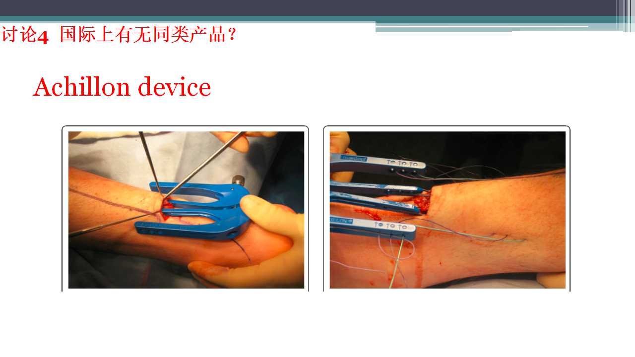 跟腱断裂治疗存在的问题及解决策略