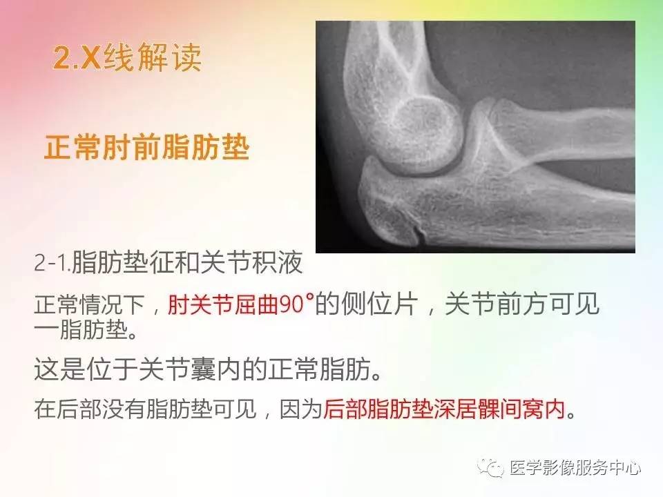 儿童肘关节骨折的分类与诊断要点