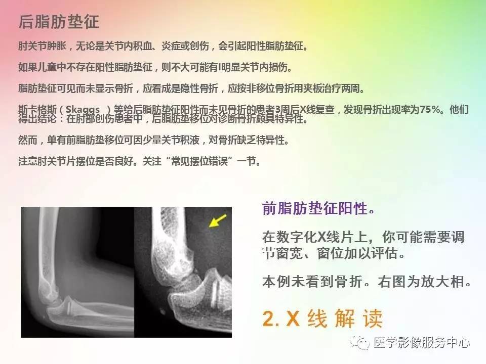 儿童肘关节骨折的分类与诊断要点