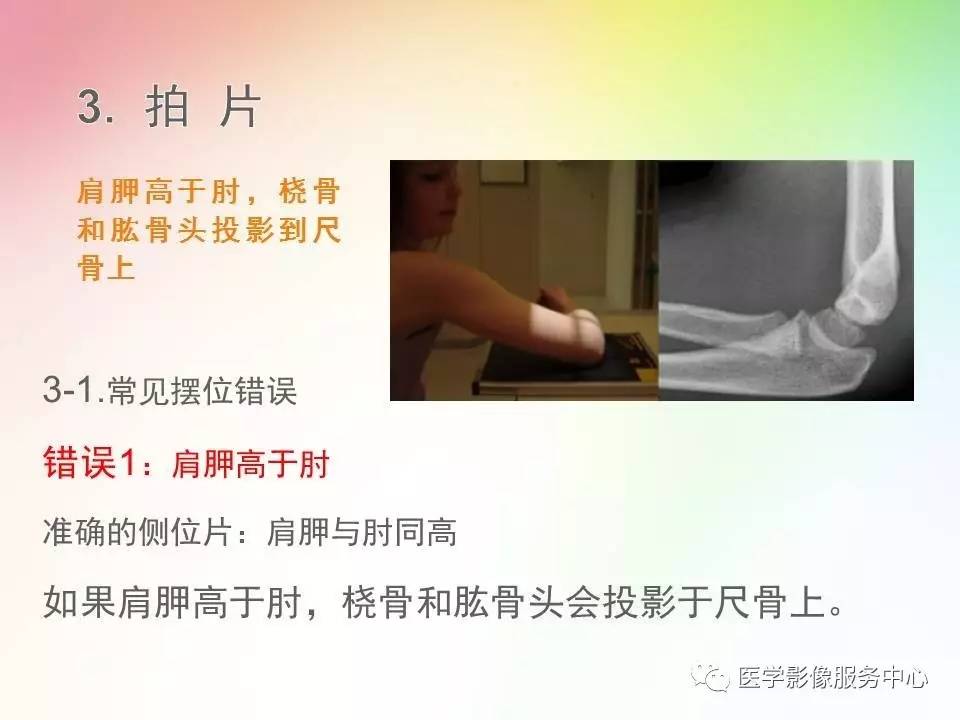 儿童肘关节骨折的分类与诊断要点