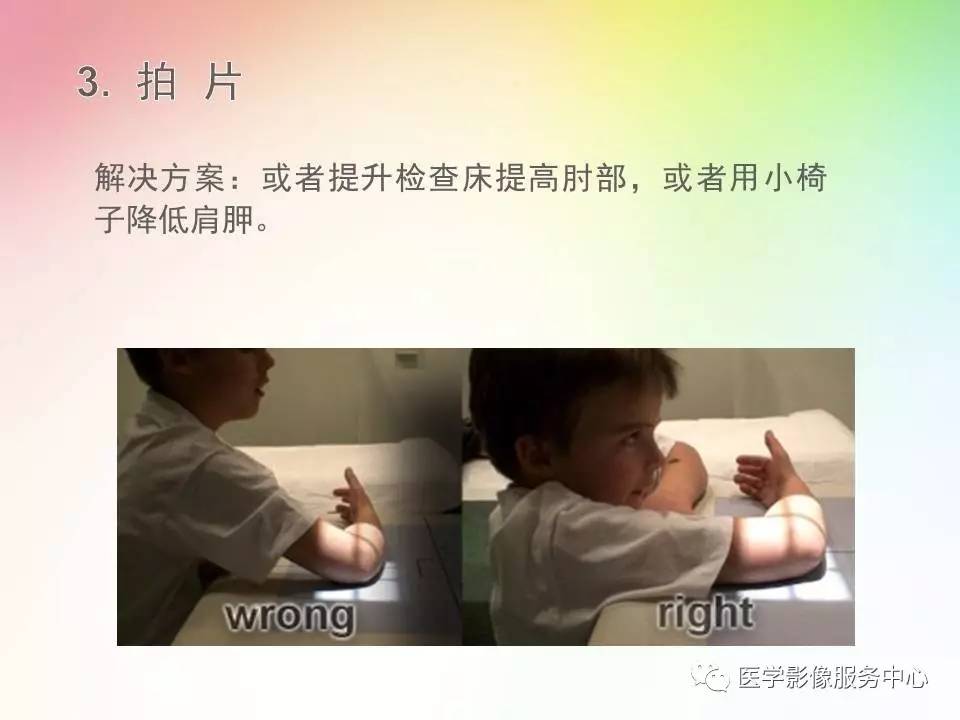 儿童肘关节骨折的分类与诊断要点