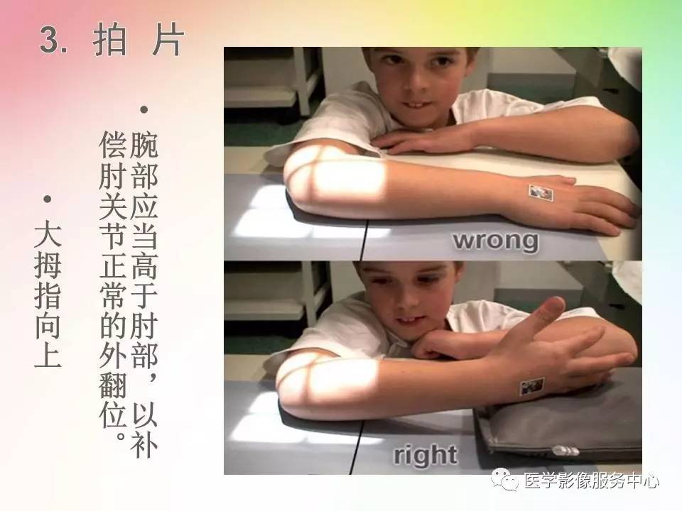 儿童肘关节骨折的分类与诊断要点