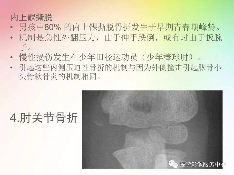儿童肘关节骨折的分类与诊断要点