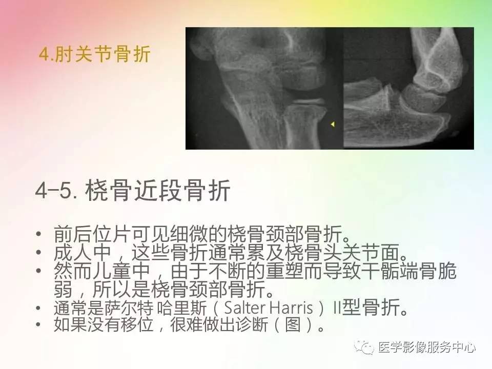 儿童肘关节骨折的分类与诊断要点