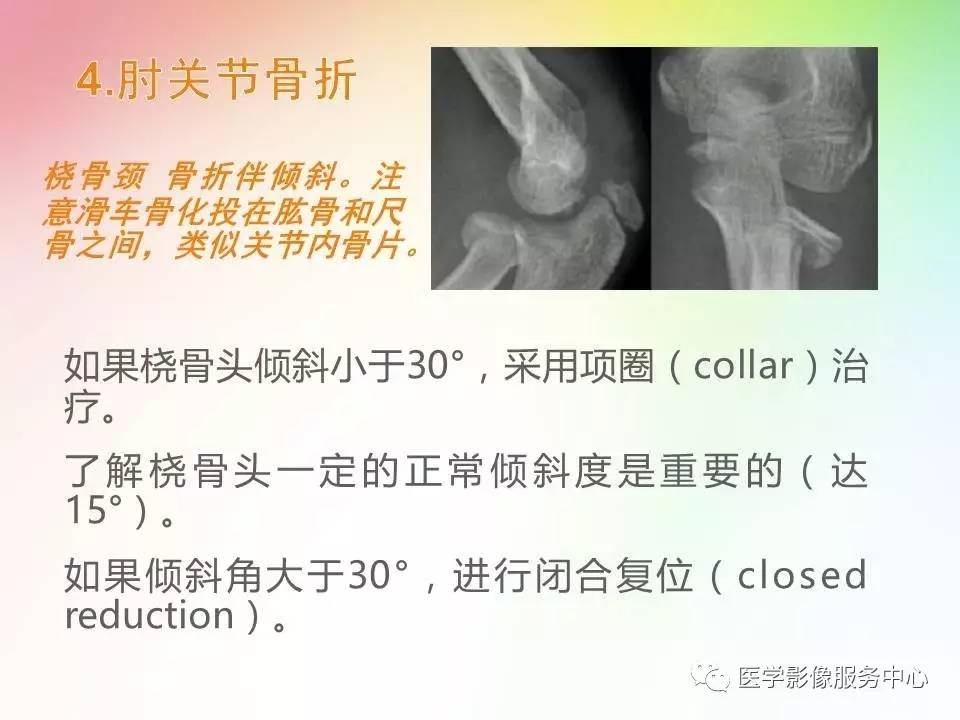 儿童肘关节骨折的分类与诊断要点
