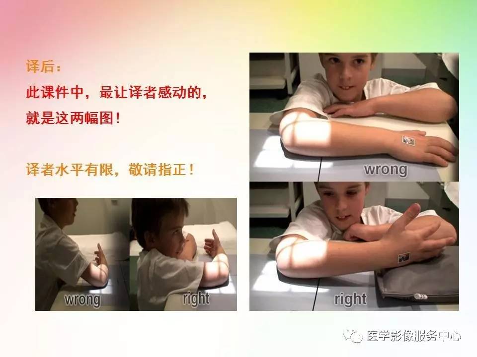 儿童肘关节骨折的分类与诊断要点