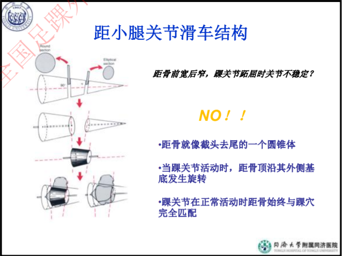 治疗踝骨折，你必须了解的足踝部的生物力学