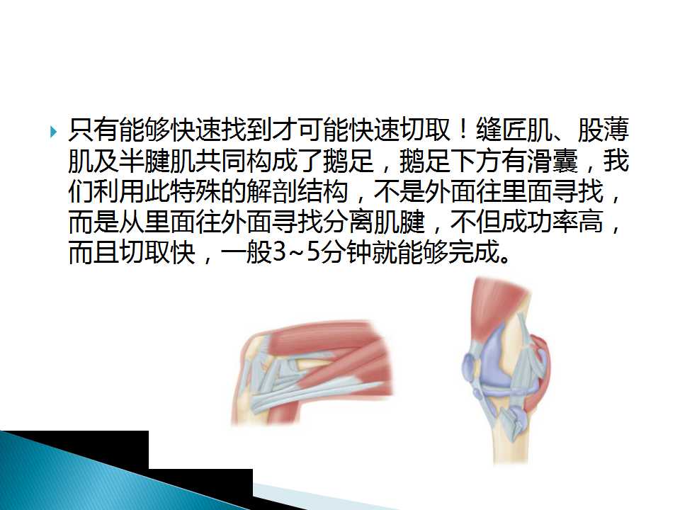 如何能够快速切取腘绳肌腱？