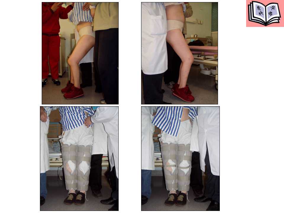 全膝关节置换的手术原则