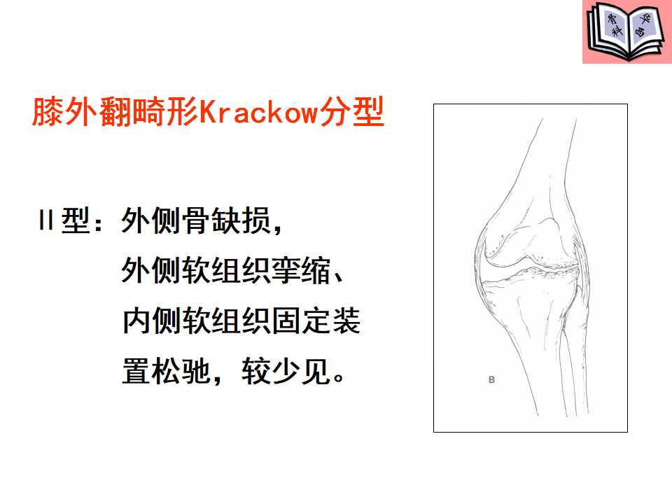 全膝关节置换的手术原则