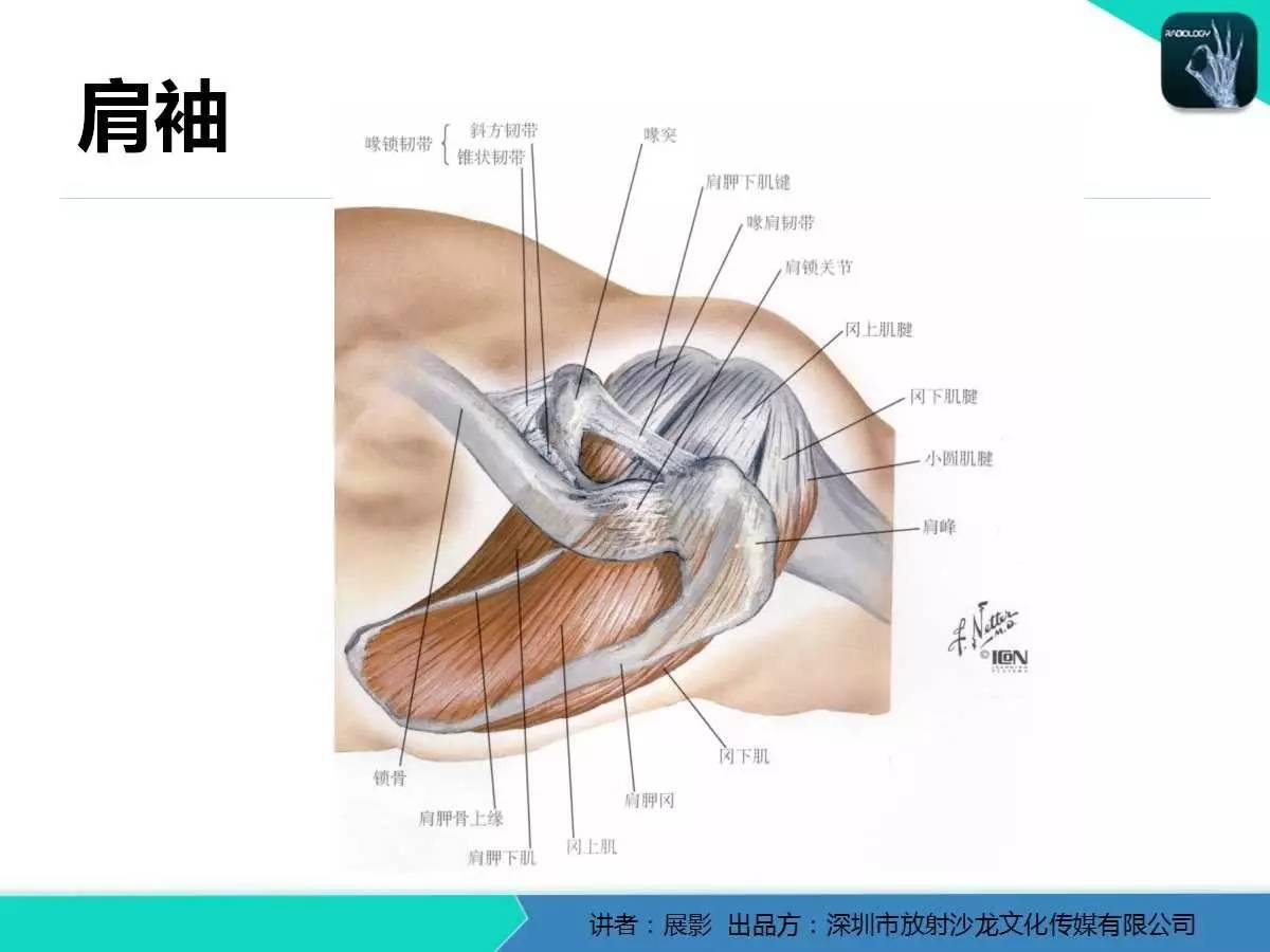 肩峰下撞击综合征和肩袖损伤的MR表现