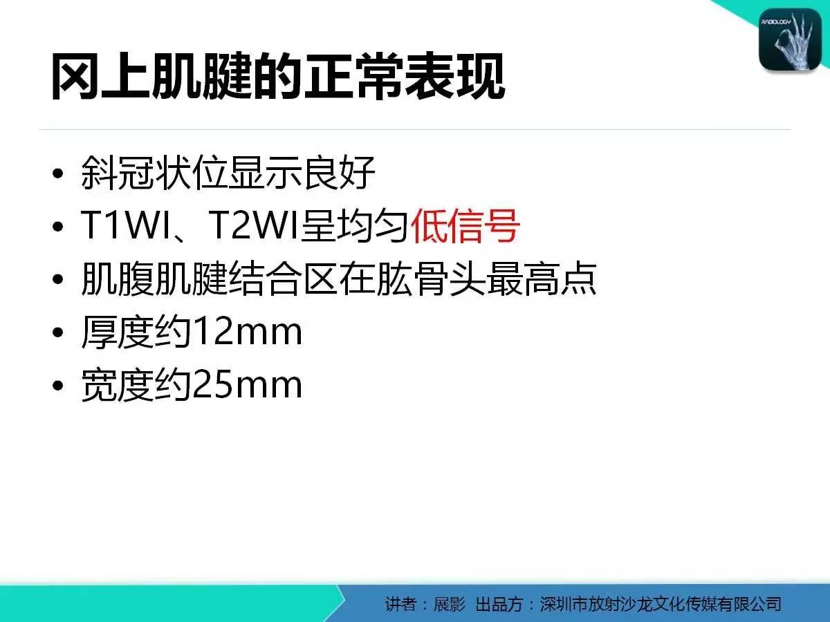 肩峰下撞击综合征和肩袖损伤的MR表现