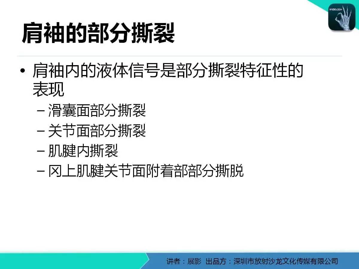 肩峰下撞击综合征和肩袖损伤的MR表现