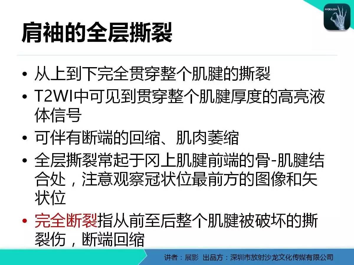 肩峰下撞击综合征和肩袖损伤的MR表现