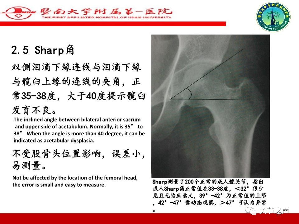 全髋关节置换的X线评估