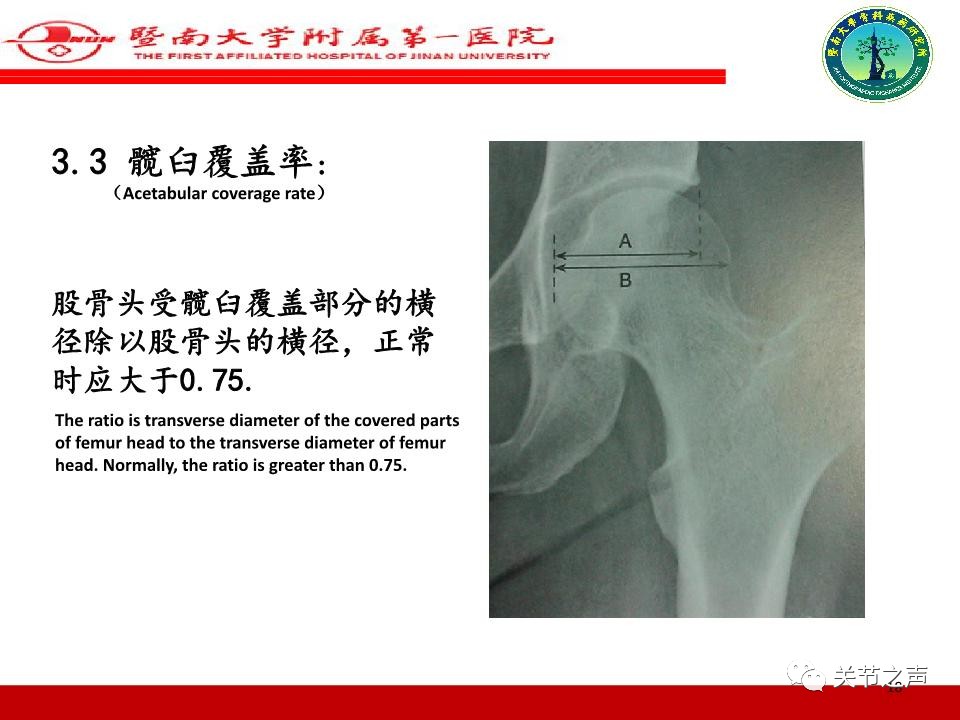 全髋关节置换的X线评估