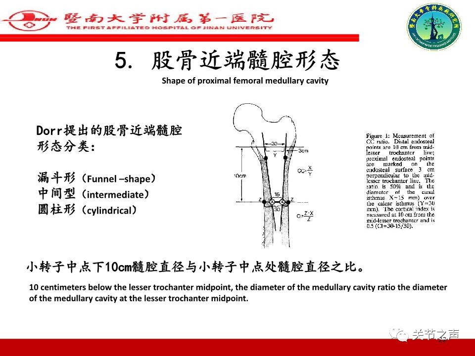 全髋关节置换的X线评估