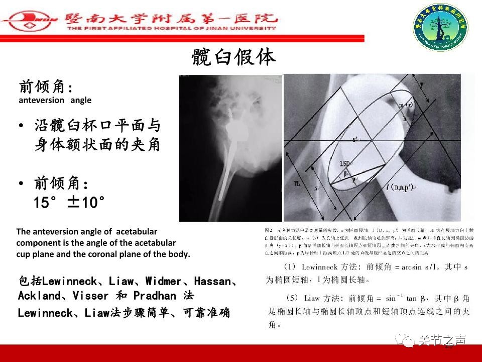 全髋关节置换的X线评估