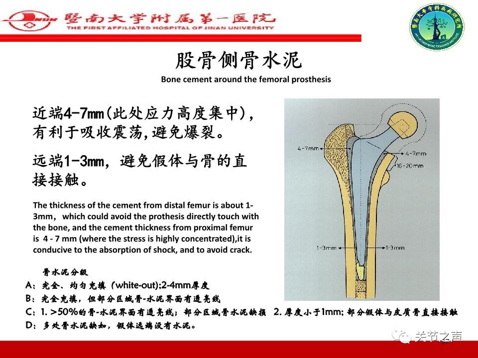 全髋关节置换的X线评估