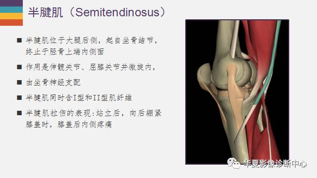 膝关节周围的那些肌腱你都认识吗？