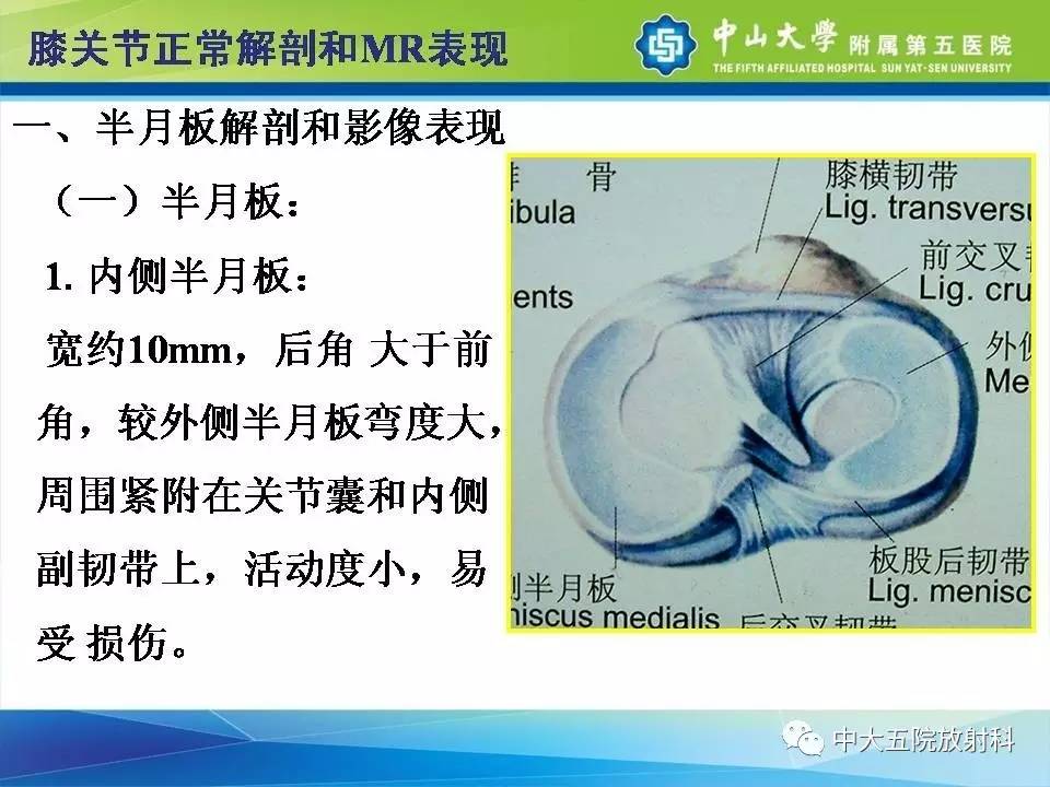 膝关节半月板和韧带损伤的影像学诊断