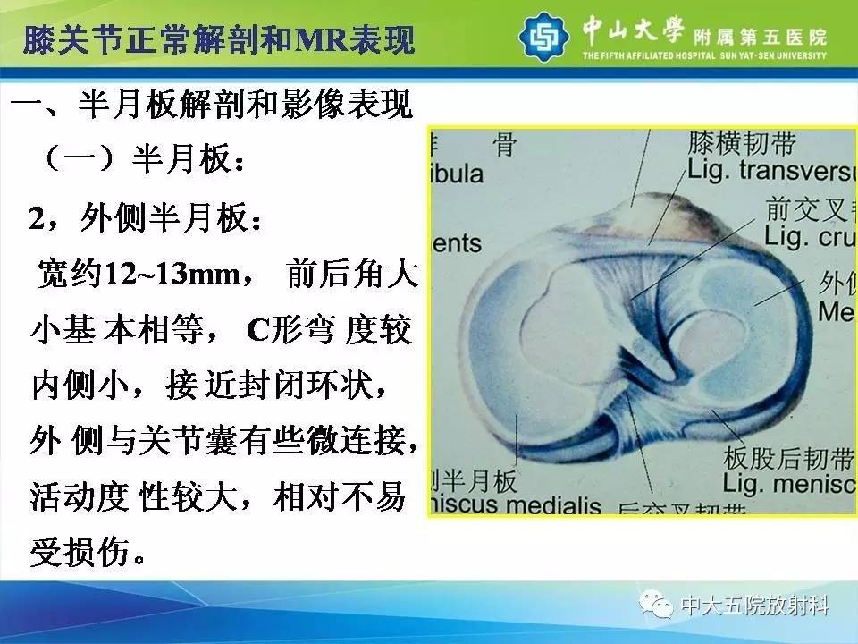 膝关节半月板和韧带损伤的影像学诊断