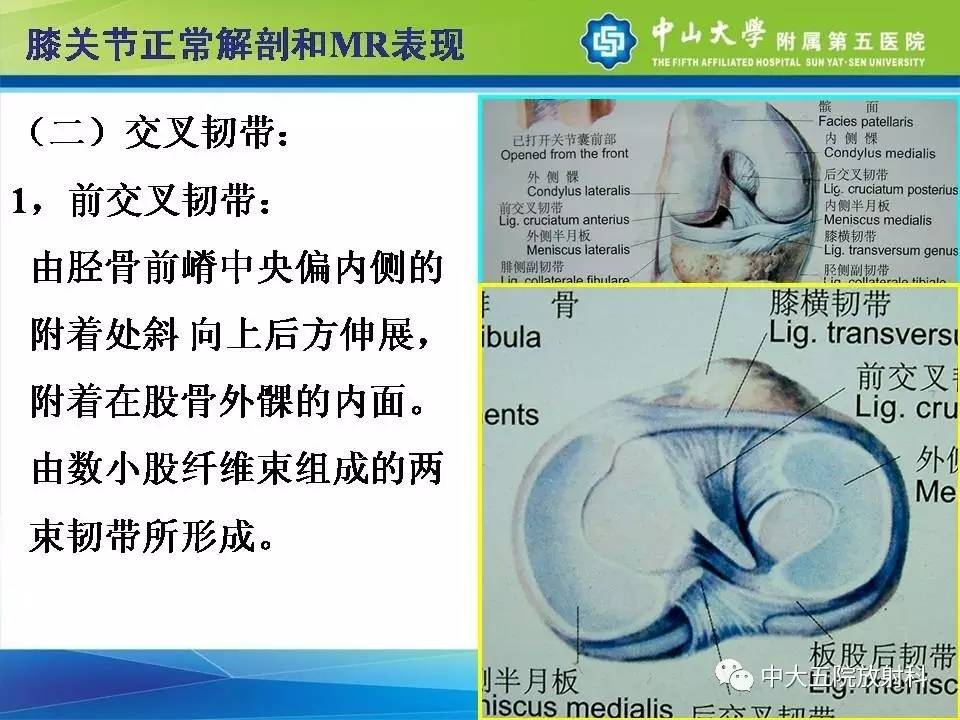 膝关节半月板和韧带损伤的影像学诊断