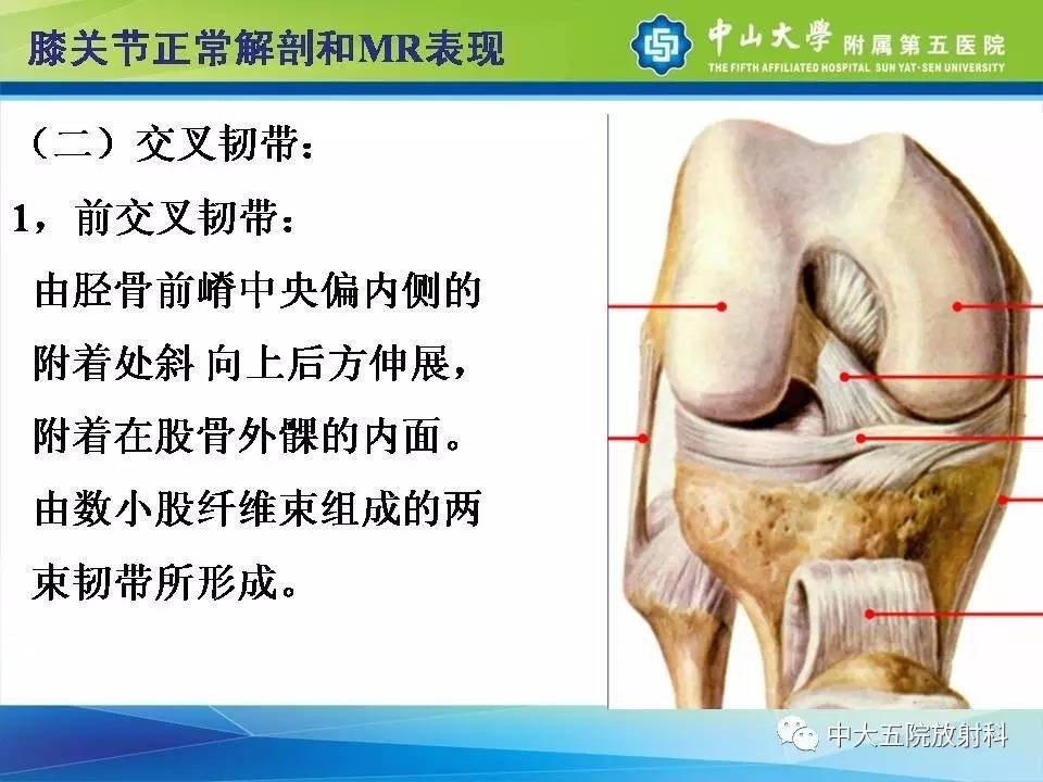 膝关节半月板和韧带损伤的影像学诊断