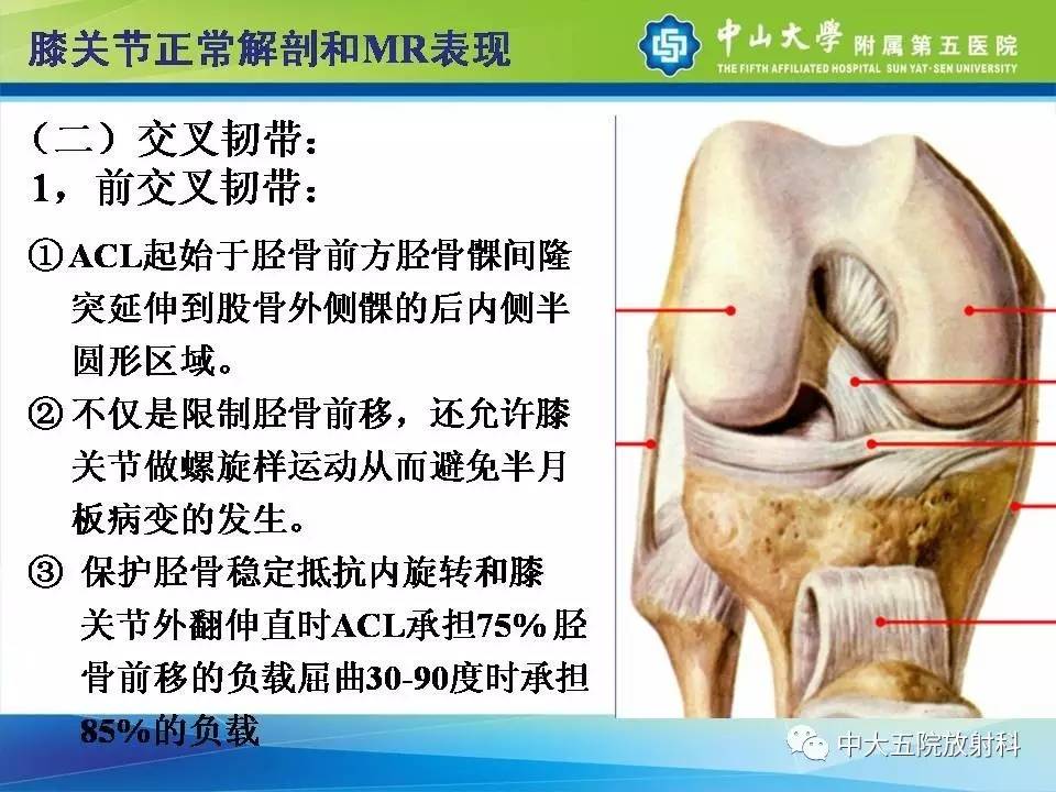 膝关节半月板和韧带损伤的影像学诊断