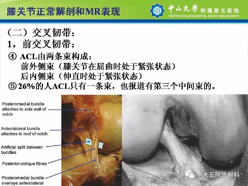 膝关节半月板和韧带损伤的影像学诊断