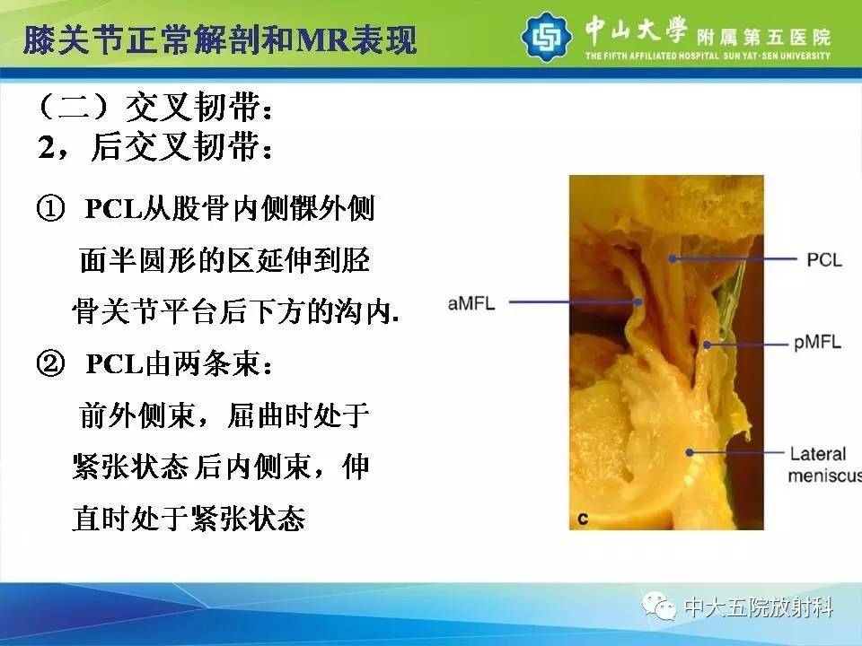 膝关节半月板和韧带损伤的影像学诊断