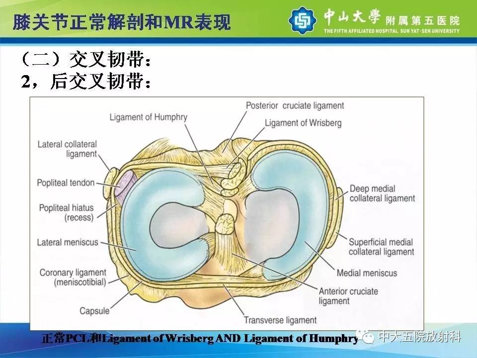 膝关节半月板和韧带损伤的影像学诊断