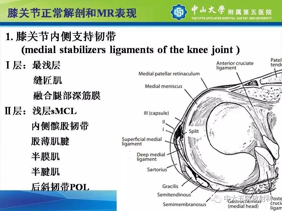 膝关节半月板和韧带损伤的影像学诊断