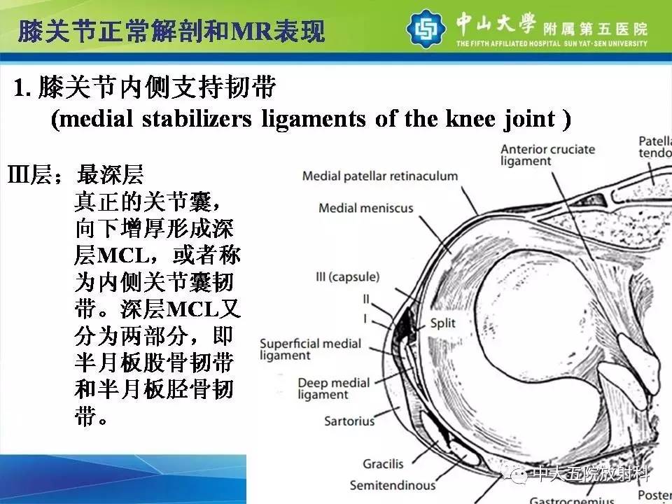 膝关节半月板和韧带损伤的影像学诊断