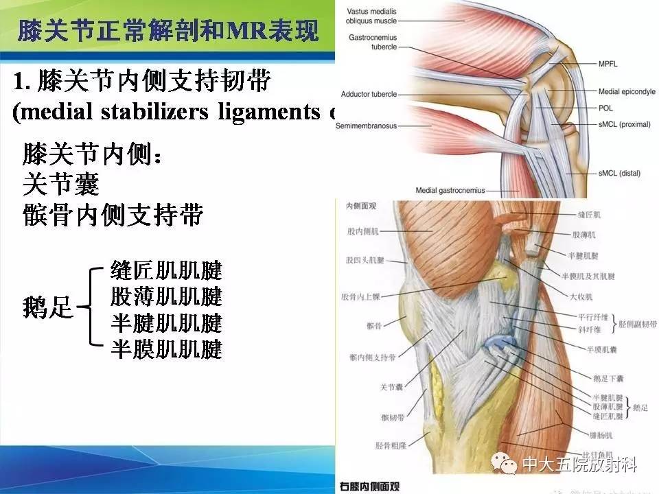 膝关节半月板和韧带损伤的影像学诊断