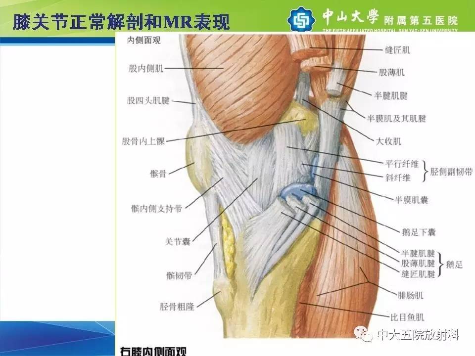 膝关节半月板和韧带损伤的影像学诊断