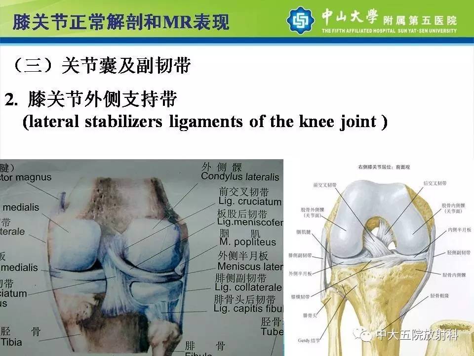 膝关节半月板和韧带损伤的影像学诊断