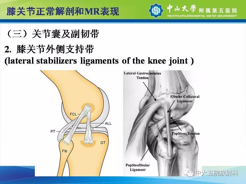 膝关节半月板和韧带损伤的影像学诊断