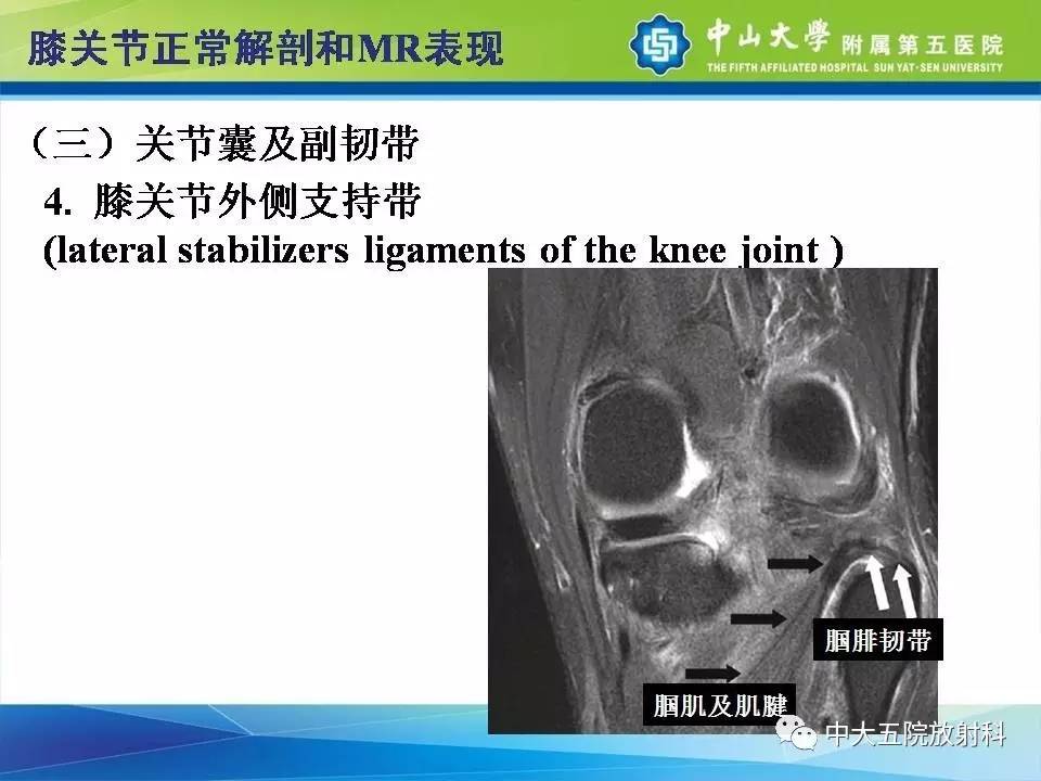 膝关节半月板和韧带损伤的影像学诊断