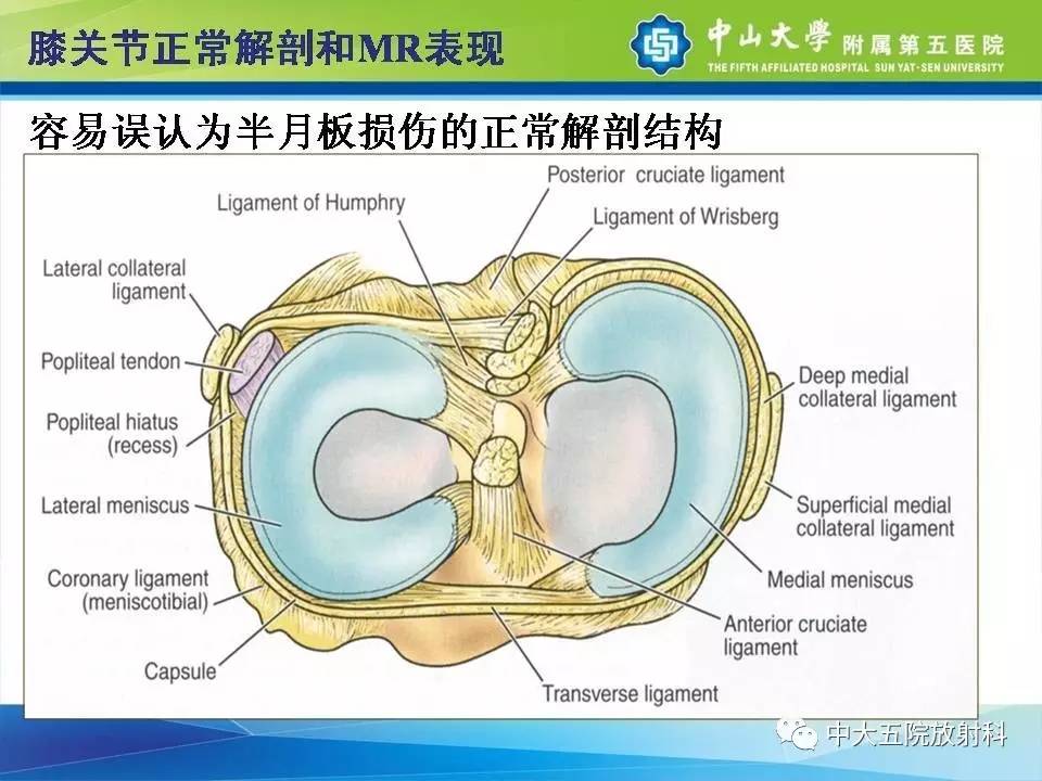 膝关节半月板和韧带损伤的影像学诊断