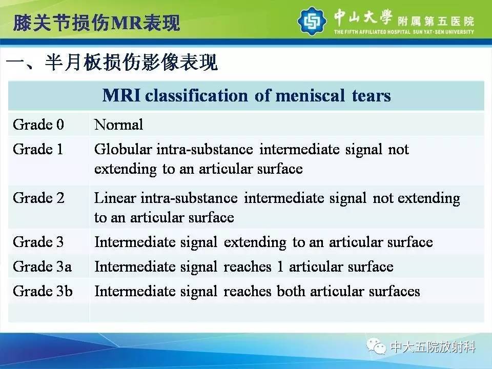 膝关节半月板和韧带损伤的影像学诊断