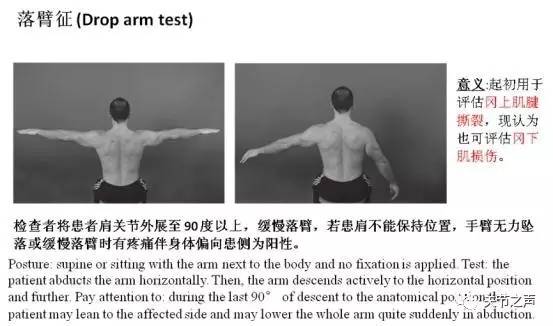 史上最全肩关节检查方法详解