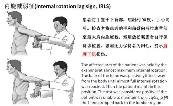 史上最全肩关节检查方法详解