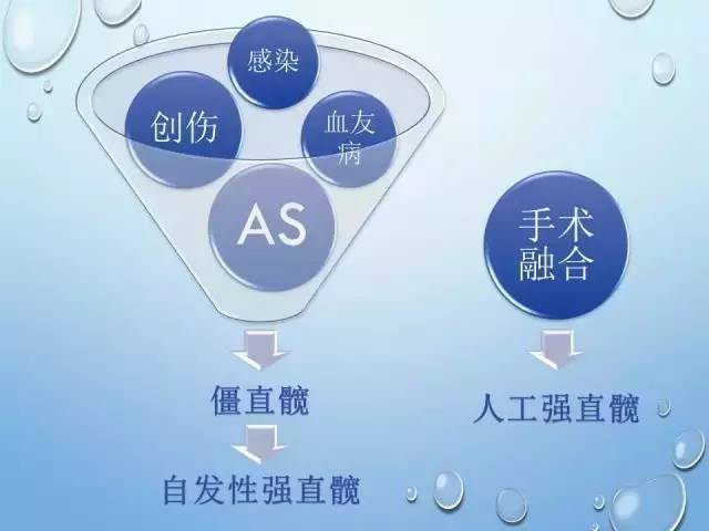 强直髋关节的人工关节置换技巧