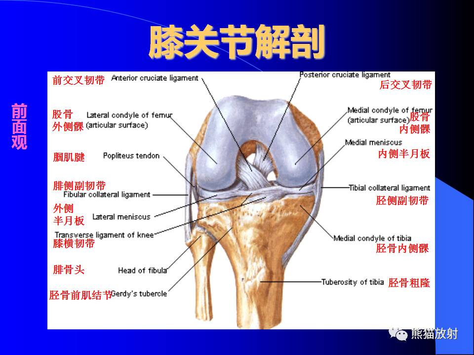 膝关节周围囊肿的MRI表现