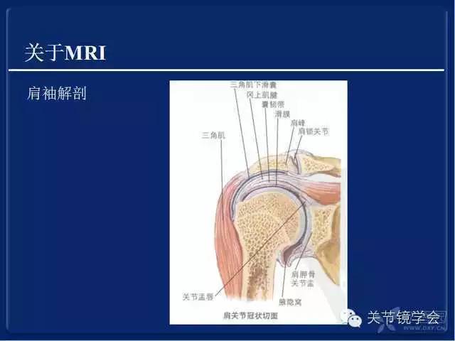 肩袖损伤的诊断与治疗策略