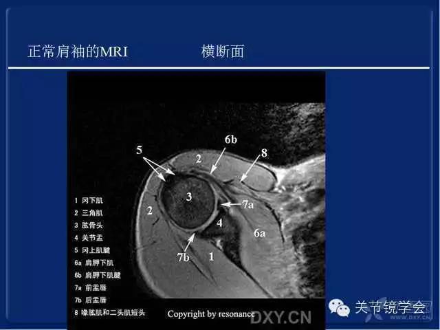 肩袖损伤的诊断与治疗策略