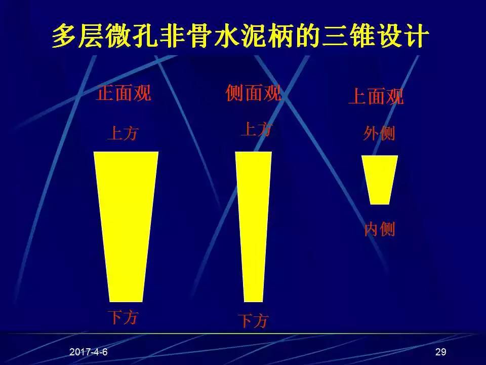 髋关节置换手术技巧及并发症的防范